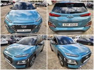 Hyundai Kona 2017